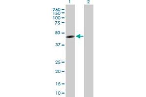 Western Blot analysis of TTRAP expression in transfected 293T cell line by TTRAP MaxPab polyclonal antibody. (TDP2 anticorps  (AA 1-362))