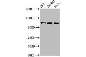 Western Blot Positive WB detected in: 293 whole cell lysate, Jurkat whole cell lysate, Hela whole cell lysate All lanes: RAB3GAP1 antibody at 7 μg/mL Secondary Goat polyclonal to rabbit IgG at 1/50000 dilution Predicted band size: 111, 112, 106 kDa Observed band size: 111 kDa (RAB3GAP1 anticorps  (Catalytic Subunit))