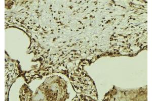 ABIN6269347 at 1/100 staining Mouse colon tissue by IHC-P.