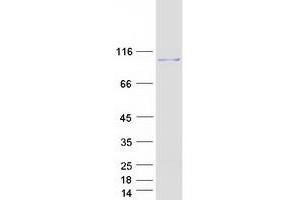 Validation with Western Blot