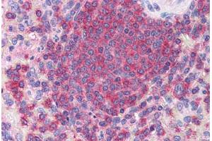 Human Spleen (formalin-fixed, paraffin-embedded) stained with ARPC2 antibody ABIN351464 at 3. (ARPC2 anticorps  (AA 288-300))