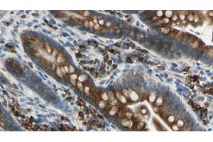 ABIN6274670 at 1/100 staining Mouse intestine tissue by IHC-P. (GRID1 anticorps  (Internal Region))