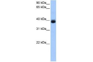 SERPINA5 antibody used at 1 ug/ml to detect target protein.