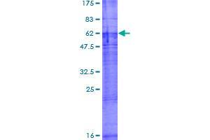 Image no. 1 for Solute Carrier Family 22 Member 18 (SLC22A18) (AA 1-424) protein (GST tag) (ABIN1320200)