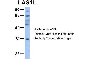 Host:  Rabbit  Target Name:  LAS1L  Sample Type:  Human Fetal Brain  Antibody Dilution:  1. (LAS1L anticorps  (Middle Region))