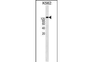 Western blot analysis in K562 cell line lysates (35ug/lane). (P-Glycoprotein anticorps  (AA 647-677))