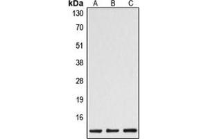 Western blot analysis of Caspase 1 p10 expression in HeLa (A), mouse spleen (B), rat spleen (C) whole cell lysates. (Caspase 1 (p10) anticorps  (C-Term))