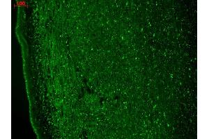 Immunohistochemistry analysis using Mouse Anti-CaV3.
