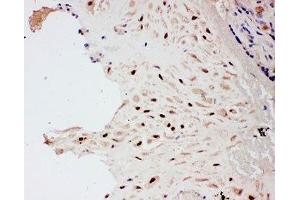 IHC-P: PIAS1 antibody testing of human placenta tissue