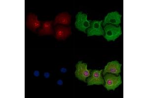 ABIN6258571 and ABIN6274564 staining Hela cells by IF/ICC. (14-3-3 eta anticorps  (Internal Region))