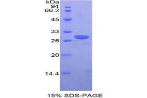 SDS-PAGE analysis of Mouse Pim-2 Oncogene Protein. (PIM2 Protéine)