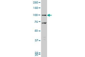 PROX1 monoclonal antibody (M09), clone 1H6 Western Blot analysis of PROX1 expression in MCF-7 . (PROX1 anticorps  (AA 638-737))