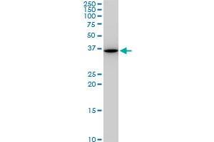SNAI2 monoclonal antibody (M05), clone 3C12.