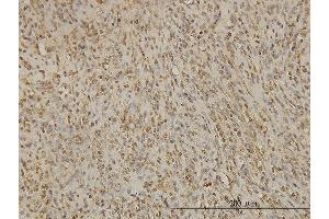 Immunoperoxidase of monoclonal antibody to BUB1B on formalin-fixed paraffin-embedded human spleen.