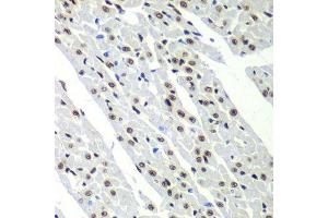 Immunohistochemistry of paraffin-embedded rat heart using SF3B2 antibody.