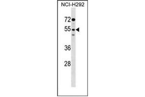 Western blot analysis of D172g / SIRPG in NCI-H292 cell line lysates (35ug/lane). (SIRPG anticorps  (Middle Region))