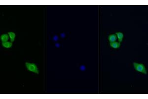 Detection of PIK3Cb in Human Hela cell using Polyclonal Antibody to Phosphoinositide-3-Kinase Catalytic Beta Polypeptide (PIK3Cb) (PIK3CB anticorps  (AA 807-1070))