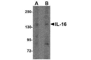 Image no. 1 for anti-Interleukin 16 (IL16) (N-Term) antibody (ABIN341724) (IL16 anticorps  (N-Term))