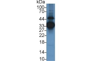 Detection of ANXA3 in Human Lung lysate using Monoclonal Antibody to Annexin A3 (ANXA3) (Annexin A3 anticorps  (AA 190-312))