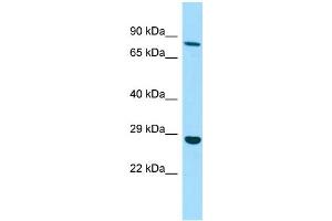 WB Suggested Anti-EMILIN3 Antibody Titration: 1. (EMILIN3 anticorps  (C-Term))