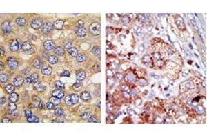 Image no. 3 for anti-6-phosphofructo-2-Kinase/fructose-2,6-Biphosphatase 4 (PFKFB4) (AA 274-303) antibody (ABIN360670)