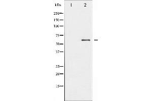 Western blot analysis of Src phosphorylation expression in serum treated COLO205 whole cell lysates,The lane on the left is treated with the antigen-specific peptide.