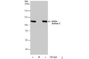 IP Image Immunoprecipitation of alpha Actinin 3 protein from HeLa whole cell extracts using 5 μg of alpha Actinin 3 antibody, Western blot analysis was performed using alpha Actinin 3 antibody, EasyBlot anti-Rabbit IgG  was used as a secondary reagent.