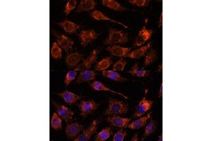 Immunofluorescence analysis of L929 cells using GPR antibody (ABIN7267314) at dilution of 1:100.