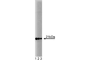 Western blot analysis of Rac1 on a rat cerebrum lysate. (RAC1 anticorps)