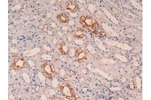 Detection of CK19 in Human Kidney Tissue using Monoclonal Antibody to Cytokeratin 19 (CK19)