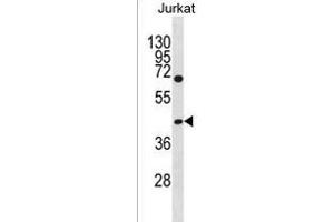 GCNT6 Antibody (C-term) (ABIN1536996 and ABIN2850077) western blot analysis in Jurkat cell line lysates (35 μg/lane). (GCNT6 anticorps  (C-Term))