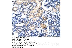 Rabbit Anti-EMG1 Antibody  Paraffin Embedded Tissue: Human Kidney Cellular Data: Epithelial cells of renal tubule Antibody Concentration: 4. (EMG1 anticorps  (N-Term))