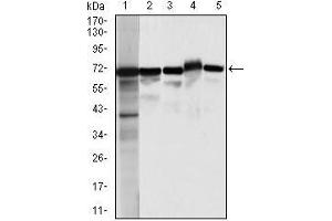 Western blot analysis using MSN mouse mAb against HeLa (1), A431 (2),Jurkat(3), HEK293(4), and COS7 (5) cell lysate. (Moesin anticorps)