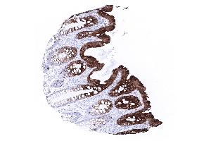 colon descendens mucosa