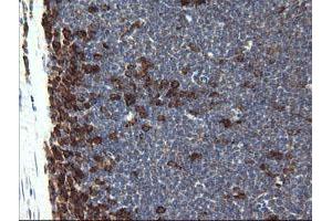 Image no. 7 for anti-Pogo Transposable Element with KRAB Domain (POGK) antibody (ABIN1500328)