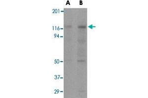 Western blot analysis of APAF1 in K-562 cell lysate with APAF1 monoclonal antibody, clone 2E10  at (A) 0. (APAF1 anticorps  (C-Term))