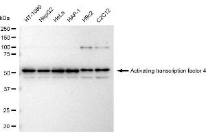 Western blotting analysis using Activating transcription factor 4 antibody (ABIN7797483).