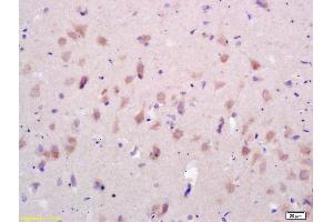 Formalin-fixed and paraffin embedded rat brain labeled with Rabbit Anti GluR1/AMPA Polyclonal Antibody, Unconjugated (ABIN1385842) at 1:200 followed by conjugation to the secondary antibody and DAB staining (GluR1, GluR2 anticorps  (AA 141-240))