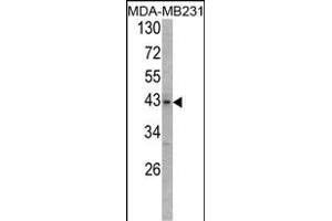 Western blot analysis of USP12/USP46 Antibody (C-term) (ABIN388899 and ABIN2839185) in MDA-M cell line lysates (35 μg/lane). (USP12,USP46 (AA 315-345), (C-Term) anticorps)