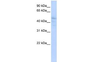 DLL3 antibody used at 1 ug/ml to detect target protein. (DLL3 anticorps)