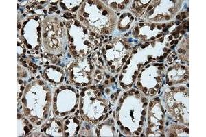 Image no. 4 for anti-Proteasome (Prosome, Macropain) 26S Subunit, ATPase, 3 (PSMC3) antibody (ABIN1501335)