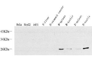 Western Blot analysis of various samples using p19 INK4d Polyclonal Antibody at dilution of 1:500. (CDKN2D anticorps)
