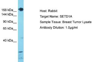 Host: Rabbit Target Name: SETD1A Sample Type: Breast Tumor lysates Antibody Dilution: 1.
