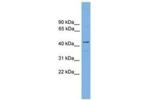 Image no. 1 for anti-Retinol Dehydrogenase 16 (All-Trans) (RDH16) (AA 215-264) antibody (ABIN6744714) (RDH16 anticorps  (AA 215-264))