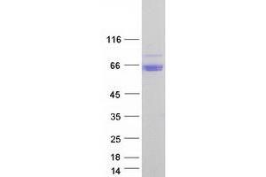 Validation with Western Blot
