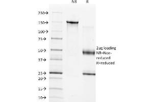 SDS-PAGE Analysis of Purified TIMP1 Mouse Monoclonal Antibody (2A5). (TIMP1 anticorps  (AA 72-82))