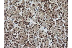 Image no. 1 for anti-Cytidine Monophosphate (UMP-CMP) Kinase 1, Cytosolic (CMPK1) antibody (ABIN1497544) (Cytidine Monophosphate (UMP-CMP) Kinase 1, Cytosolic (CMPK1) anticorps)