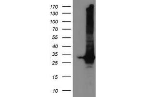 Western Blotting (WB) image for anti-Glutathione S-Transferase theta 2 (GSTT2) antibody (ABIN1498553) (GSTT2 anticorps)