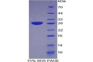 SDS-PAGE of Protein Standard from the Kit (Highly purified E. (NNMT Kit ELISA)
