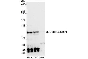 anti-Oxysterol Binding Protein-Like 9 (OSBPL9) (AA 686-736) antibody